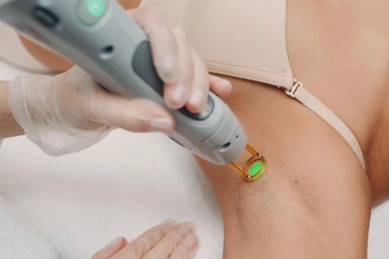 Candela GentleMax Pro Plus vs MQLASER AlexPlus Which Dual-Wavelength Laser Fits High-Volume Clinics