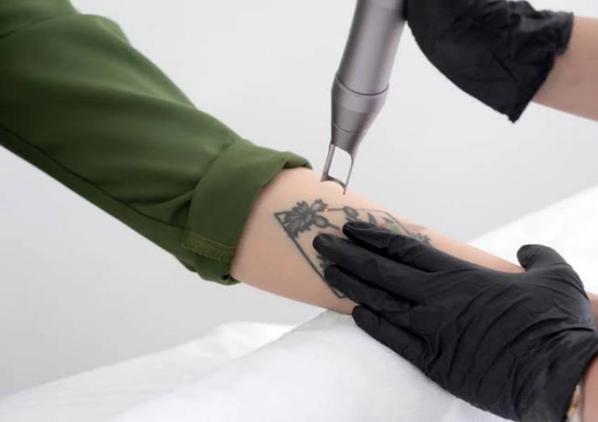Cynosure PicoSure Pro vs MQLASER DEPELITE: Which Picosecond Laser Fits Tattoo and Pigment Services