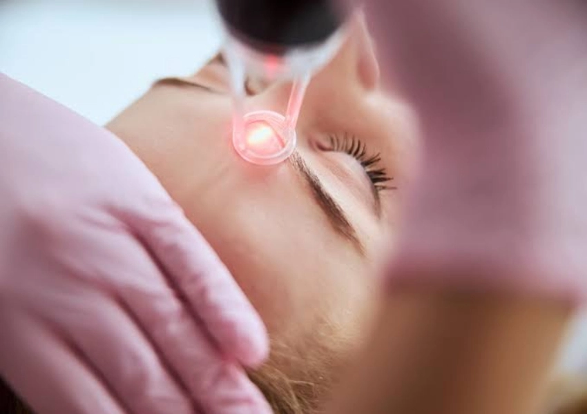 Fractional CO₂ Laser Machine Buying Guide for Skin Resurfacing Services