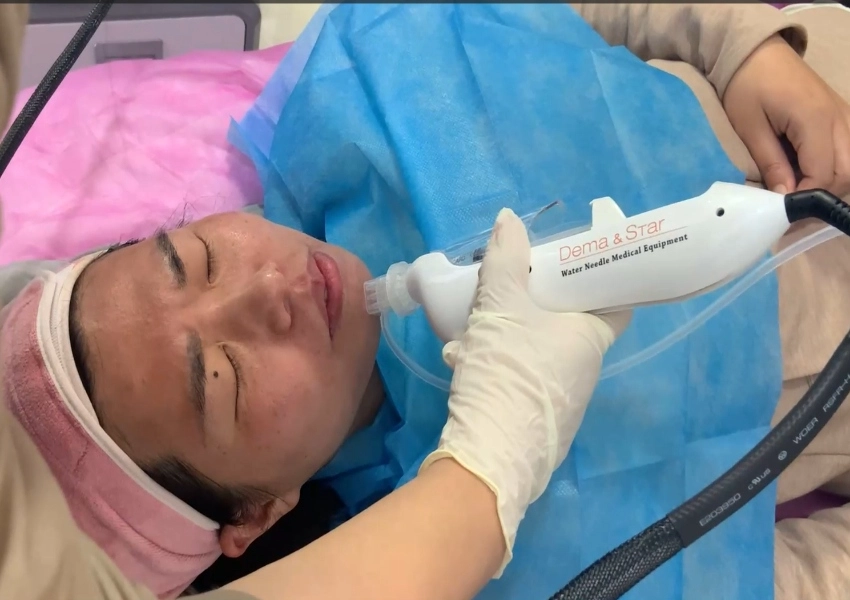 Vital Injector vs Manual Mesotherapy: Which Is Better for Beauty Service Efficiency