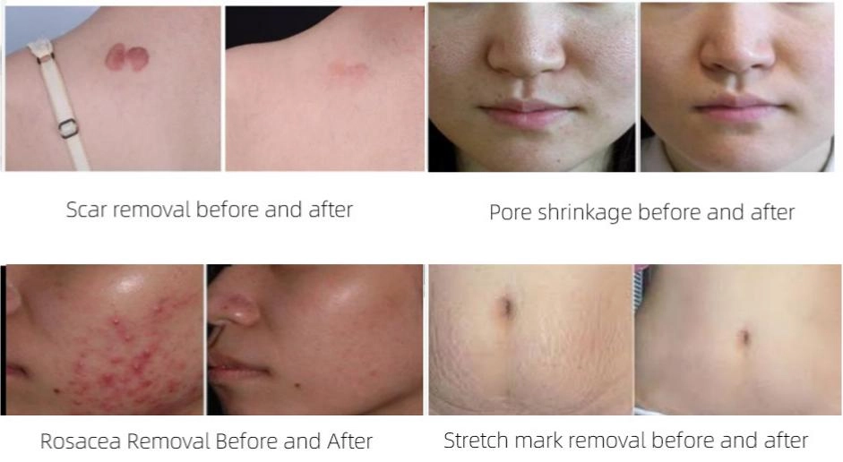 comparison before and after treatment
