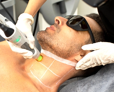 neck hair removal